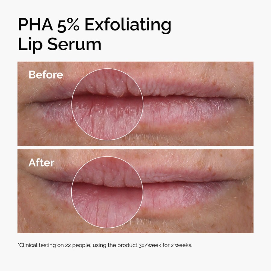 5% PHA Smoothing & Hydrating Lip Serum