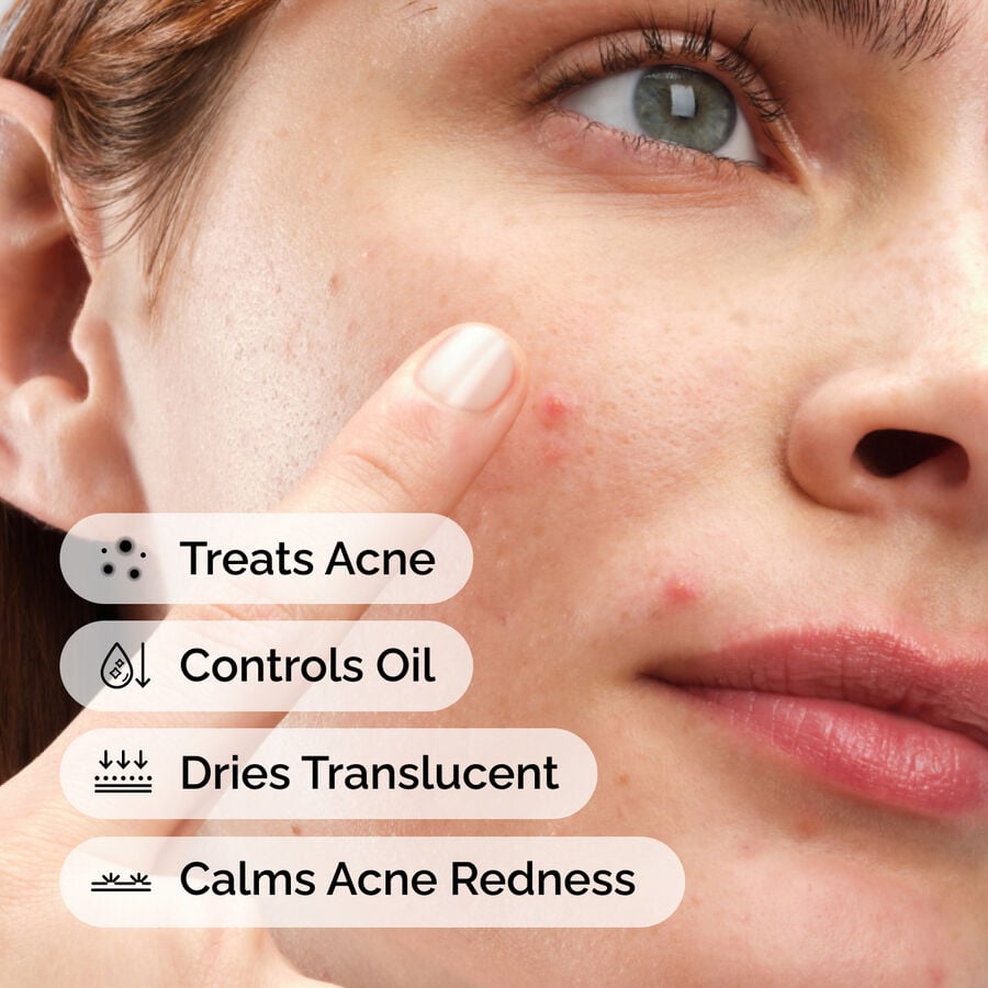 Powder-to-Cream Sulfur Concentrate for Pimples
