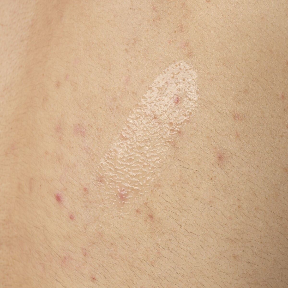 0.5% Salicylic Acid Exfoliating Body Serum