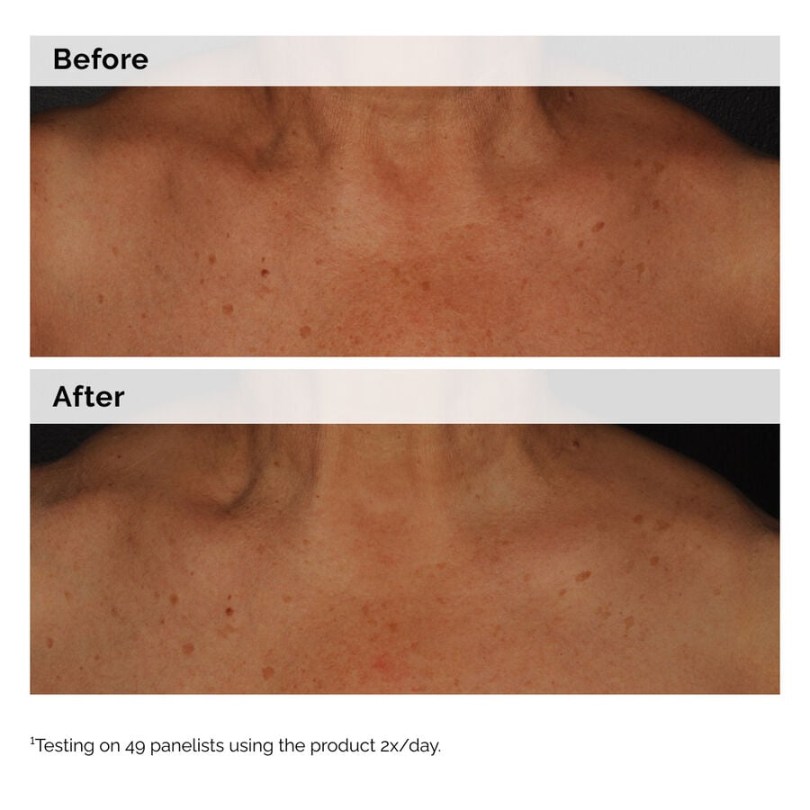 5% Niacinamide Face & Body Emulsion