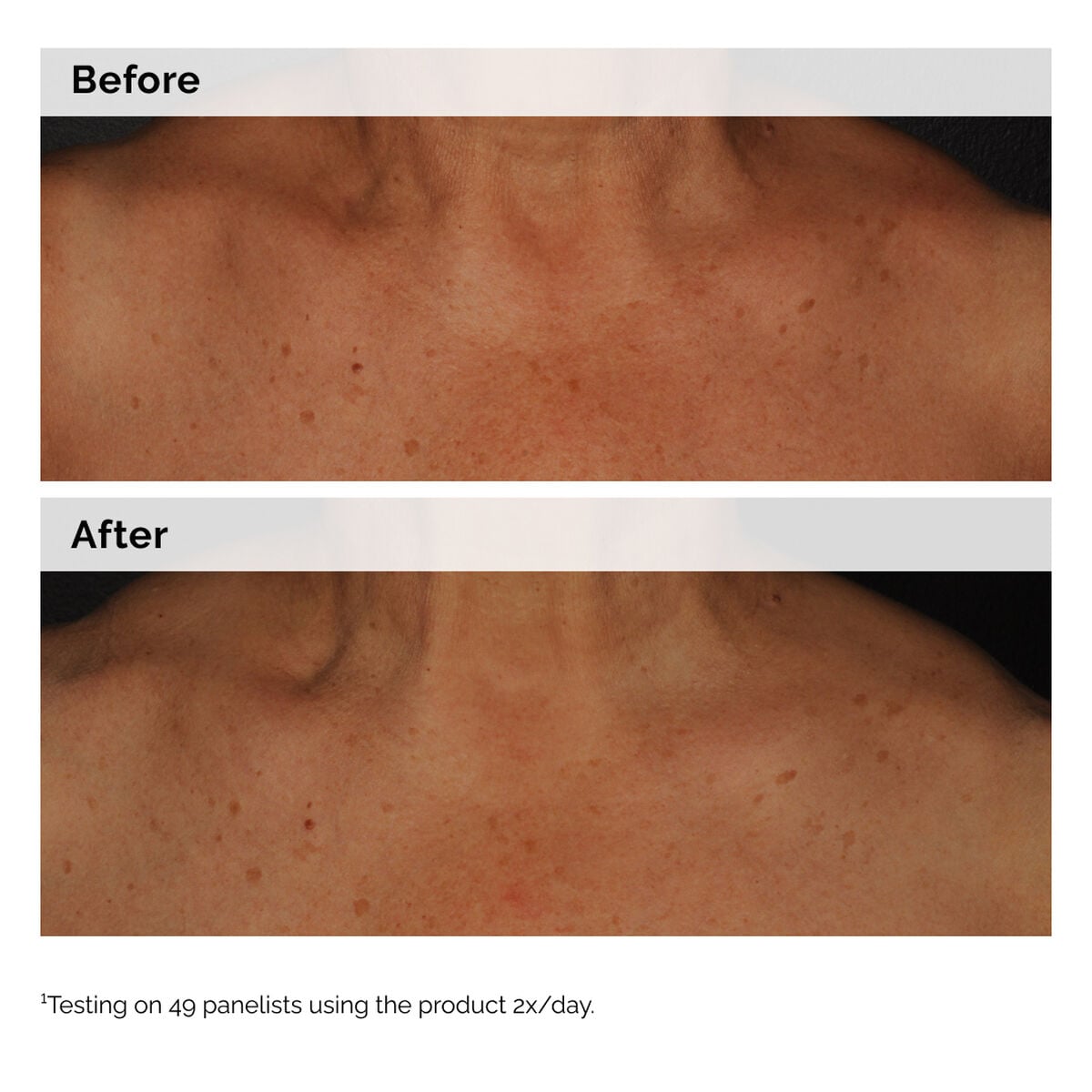 5% Niacinamide Face & Body Emulsion