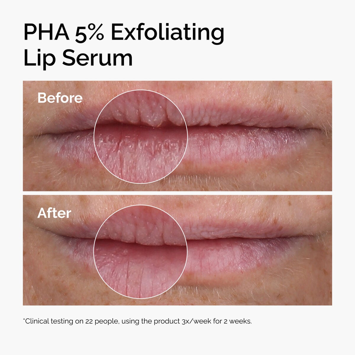 5% PHA Smoothing & Hydrating Lip Serum