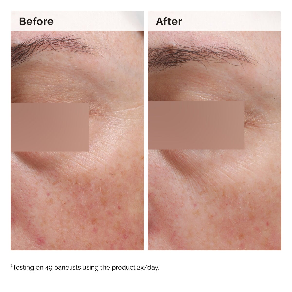 5% Niacinamide Face & Body Emulsion