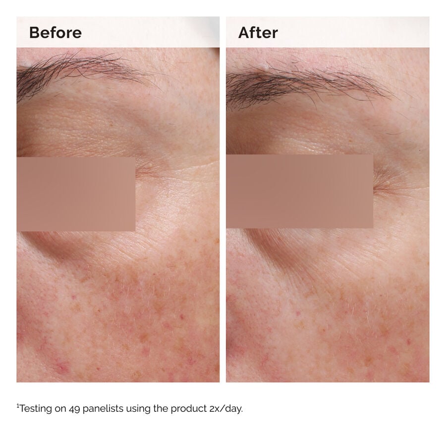 5% Niacinamide Face & Body Emulsion